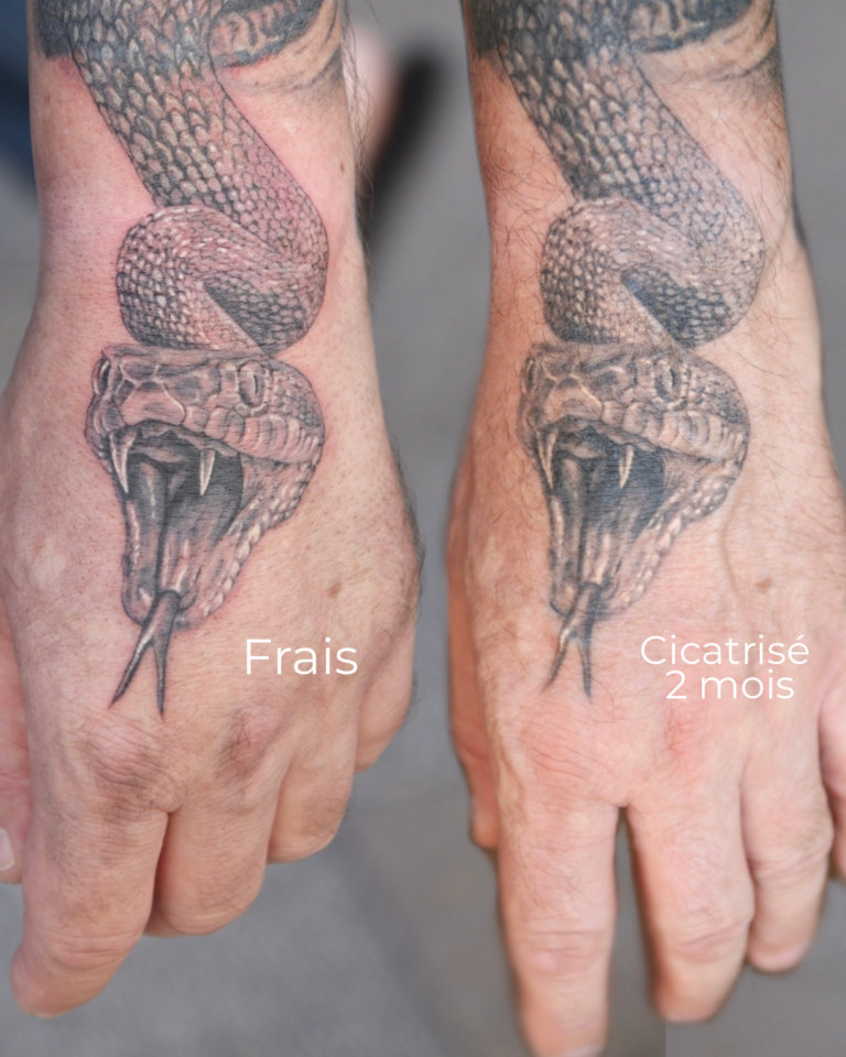 Frais - 1